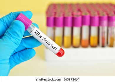 Blood Sample For Zika Virus Test
