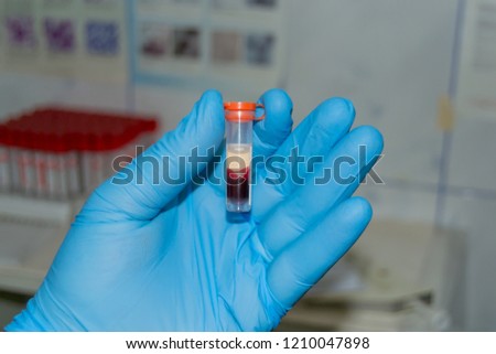 Blood samples for analysis