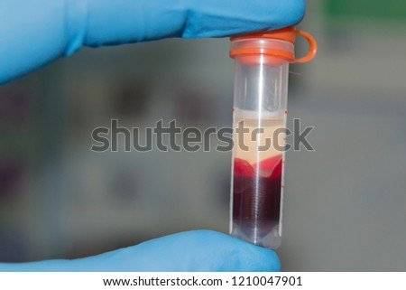 Blood samples for analysis