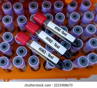 Blood Samples For Influenza A Virus Subtype H1N1, H1N2 And H1N3 Test.