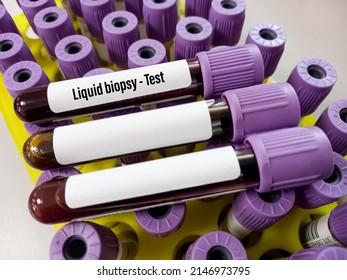 Blood Samples For Liquid Biopsy Blood Test To Detect Cancer Cells Or DNA Fragments That Circulate In The Bloodstream, Lung Cancer, Laboratory Background