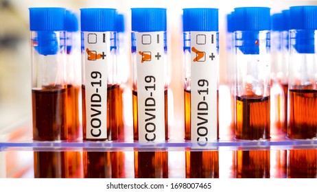Blood samples with positive Covid-19 test or coronavirus test in the test tube racks inside the laboratory - Shutterstock ID 1698007465