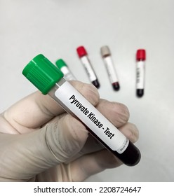 Blood Samples For Pyruvate Kinase Test For Pyruvate Kinase Deficiency. It's  An Enzyme Found In Red Blood Cells.