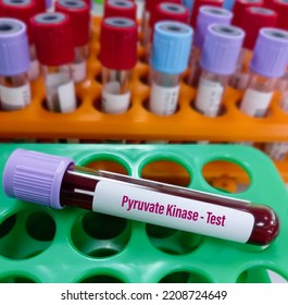 Blood Samples For Pyruvate Kinase Test For Pyruvate Kinase Deficiency. It's  An Enzyme Found In Red Blood Cells.