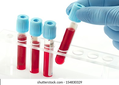 Blood samples in a rack