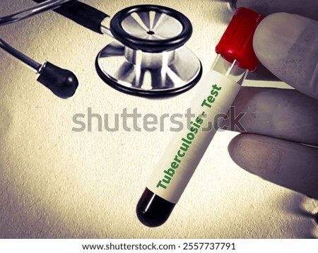 Blood samples for Tuberculosis (TB) test. diagnosis for mycobacterium tuberculosis infection.