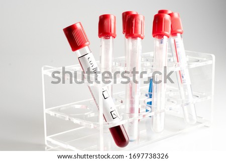 blood samples tubes test in the doctor's office.To detect  Coronavirus,Covid-19 In the hand, With wearing blue protective gloves separated on a white background.
