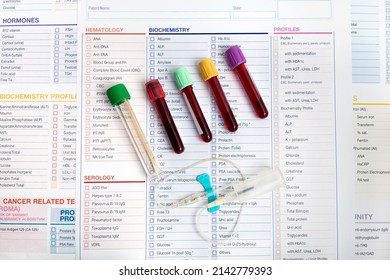 2,249 Vacuum Blood Tubes Images, Stock Photos & Vectors | Shutterstock