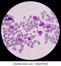 Blood smear form sepsis.septicemia can progress to sepsis.