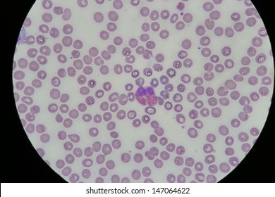 Blood Smear Show Eosinophil Stock Photo 147064622 | Shutterstock