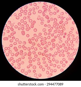 Blood Smear Under Microscope