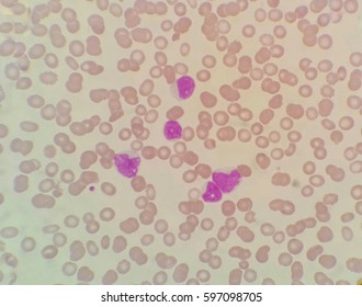 Blood Smear Under Microscope Present Red Stock Photo (Edit Now) 597098705