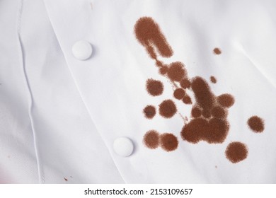 Blood Stain On Shirt Of Nurse From Working With Accident In Hospital. Dirty Stain For Cleaning Concept.