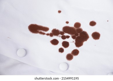 Blood Stain On Shirt Of Nurse From Working With Accident In Hospital. Dirty Stain For Cleaning Concept.