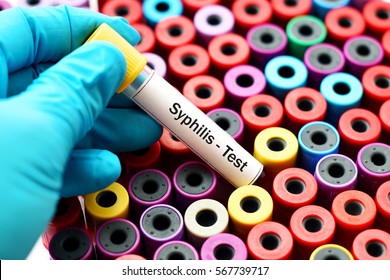 Blood For Syphilis Test