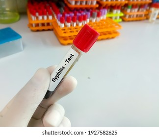 Blood For Syphilis Test, Sexually Transmitted Disease