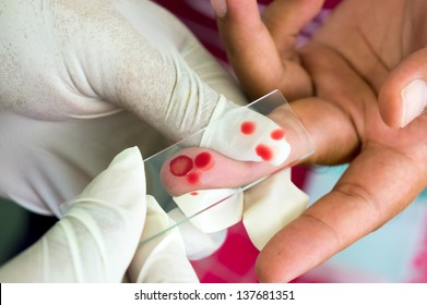 Blood Test For Malaria Parasite