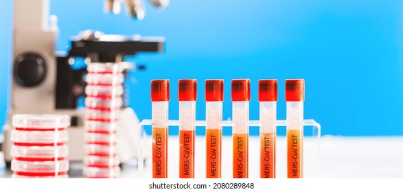 Blood Test For The Presence Of Middle East Respiratory Syndrome Coronavirus (MERS-CoV)