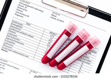 Blood Test Results On White Background Top View