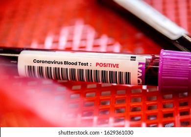 blood test tube in red basket shows positive in coronavirus on tube.