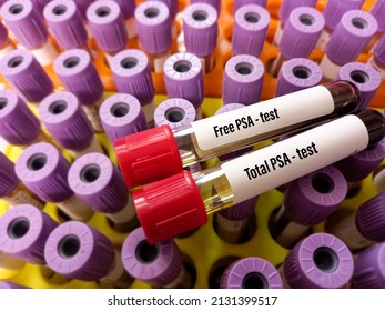 Blood test tube with sample for PSA (Total and Free) test. Prostate specific antigen, diagnosis of prostate cancer