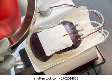 Blood transfusion. Red blood bag in laboratory. Blood donor at donation, transfusion.