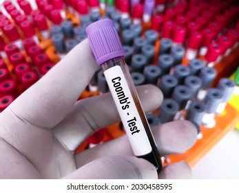 Blood Tube Sample For Coomb's Test For Autoimmune Hemolytic Anemia.