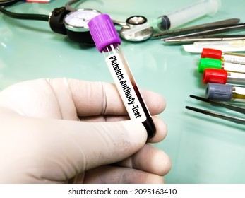 Blood Tube With Sample For Platelete Antibody Test, Thrombocytopenia,platelet Antibody, Idiopathic Thrombocytopenic Purpura.