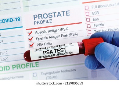Blood tube test with requisition form for PSA Prostate Specific Antigen test. Blood sample for analysis of PSA Prostate Specific Antigen profile test in laboratory