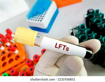 Blood Tube Test With Requisition Form For LFTs Or Liver Function Tests. ALT, AST, ALP, GGT, Bilirubin