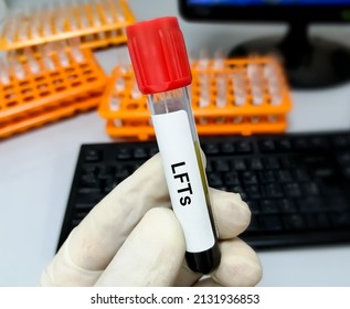 Blood Tube Test With Requisition Form For LFTs Or Liver Function Tests. ALT, AST, ALP, GGT, Bilirubin