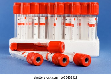 Blood Tubes Tray Laboratory Rack Blood Stock Photo (Edit Now) 1683482245