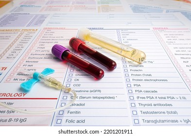 Blood Tubes And Urine Of Patient With Test Report For Analysis In The Hematology Lab. Blood Sample And Urine Collection Tubes And Supplies With Requisition Form For Analysis In The Clinical Laboratory