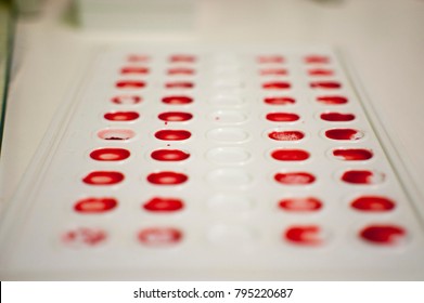 Blood Type Agglutination Chart