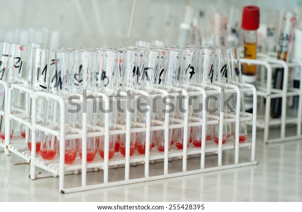 Blood Type Test Tubes Real Lab Stock Photo Edit Now 255428395