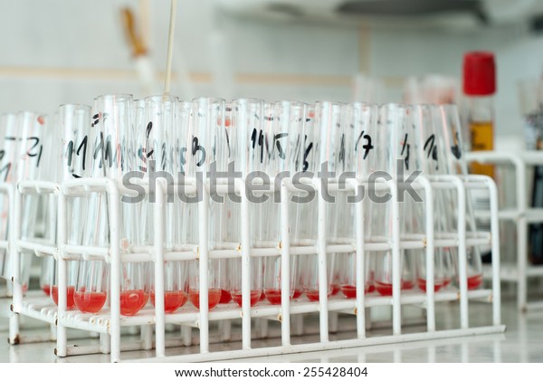 Blood Type Test Tubes Real Lab Stock Photo Edit Now 255428404