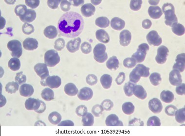 Blood Under Microscope Lymphocyte Stock Photo 1053929456 | Shutterstock