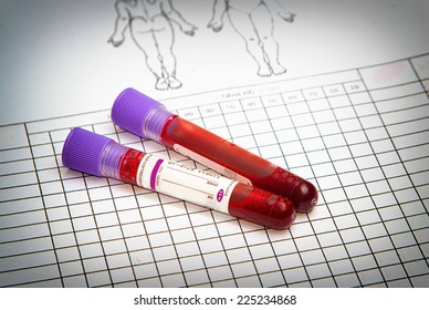 Blood Vial With Blood Sample On Record Form