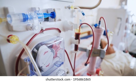 Bloodline Tubes With Hemodialysis Machine In The Background. Health Care, Blood Purification, Kidney Failure, Transplantation.