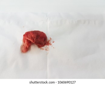 A Bloody Gauze On White Background