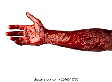 Bloody Hand Isolated On White Background.