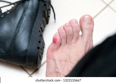 Bloody terrible blister on human feet with new black leather shoes laying around. Wet bloody painful skin on man foot with plaster. Painful wound on mans feet caused by new shoes.