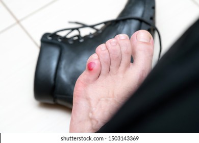 Shoe Bite High Res Stock Images Shutterstock