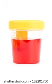 Bloody Urine, Hematuria