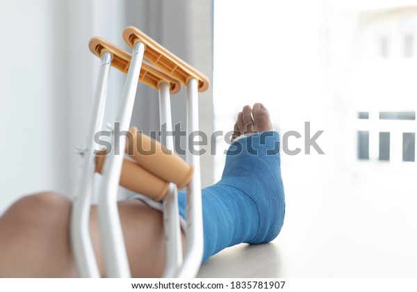 Blue ankle and foot splint Bandages on\
the legs from a young man\'s fall accident, Blue plaster on the\
ankle, Crutches assist in the walking of the\
patient.