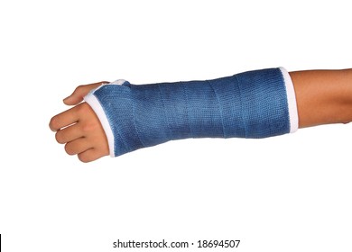 Blue Cast On An Arm Of A Child Isolated On White Background