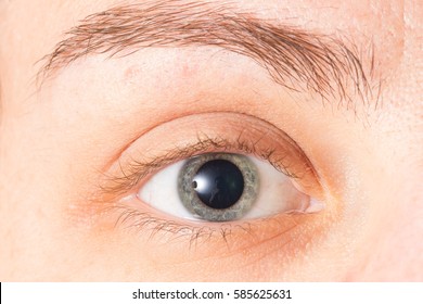 Blue Eye With Dilated Pupil