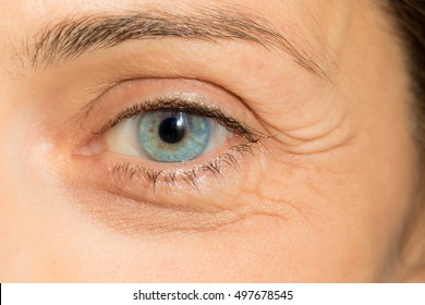 Blue eye wrinkled with crow's feet