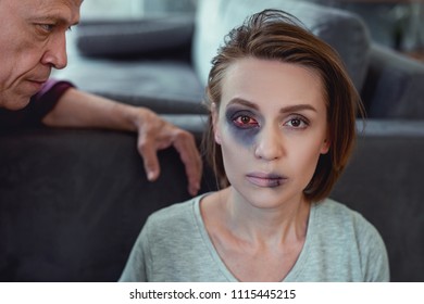 Blue Eye. Young Dark-haired Woman Feeling Scary After Big Family Dispute Having Blue Eye After Husband Violence