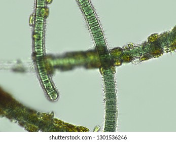 Blue Green Algae Under Microscopic View Stock Photo 1273540462 ...